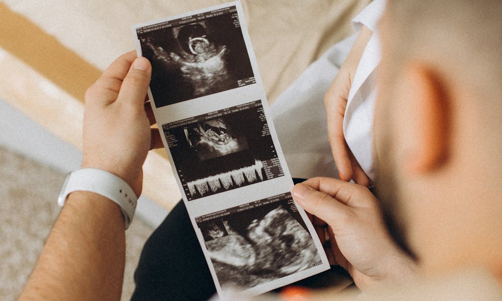 Man Watching Baby Ultrasound Scans .pexels