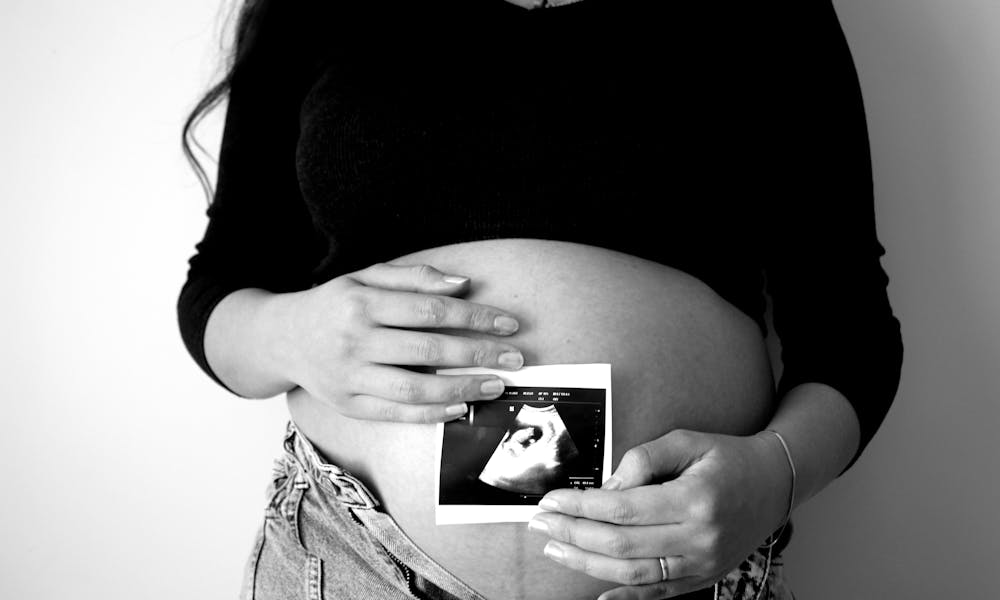A pregnant woman holds an ultrasound photo against her belly, symbolizing expecting motherhood. .pexels